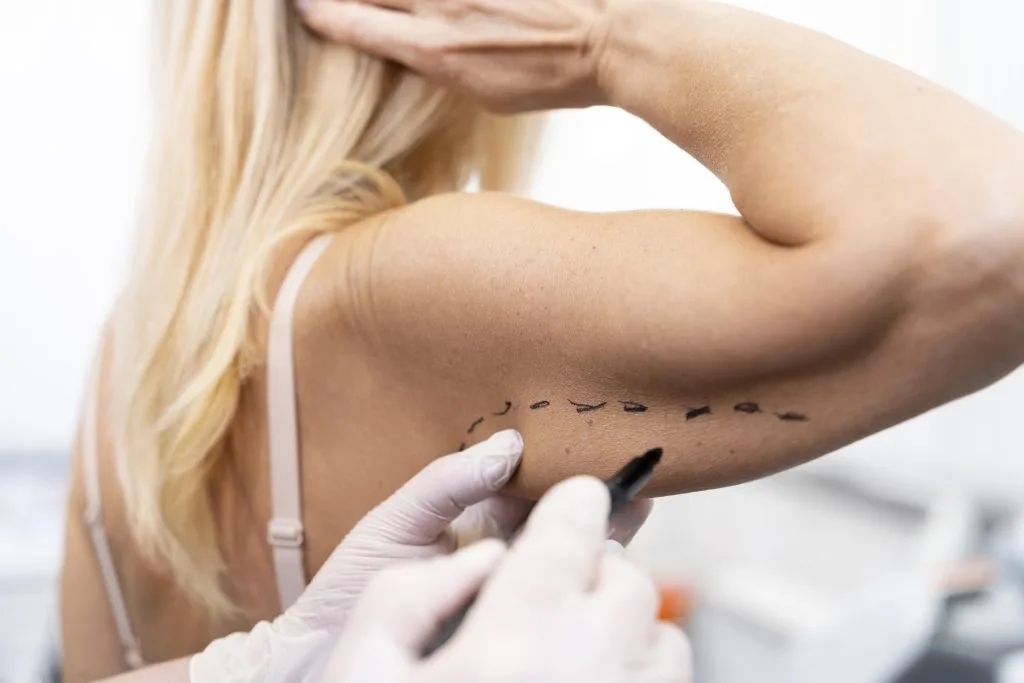 How Painful Is an Arm Lift? What You Should Know Before Surgery Banner