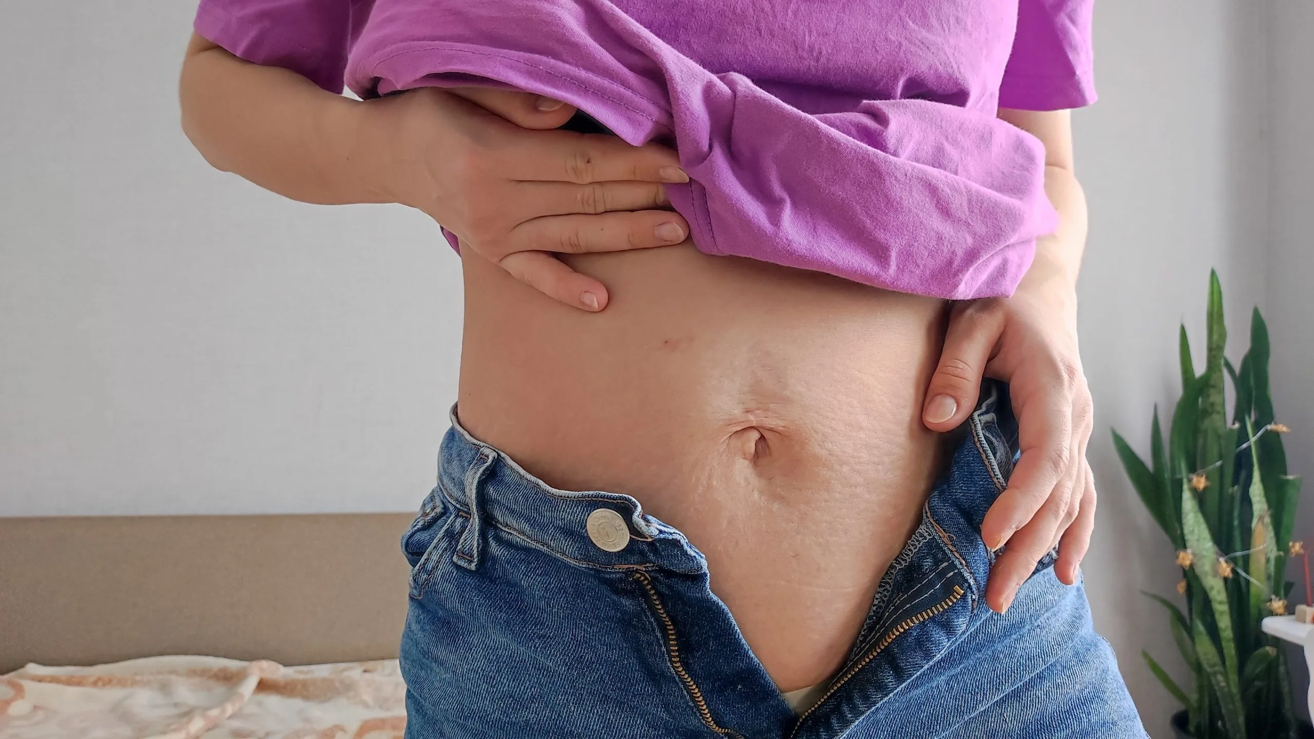 Person in purple shirt and jeans holding abdomen, showing stretched skin
