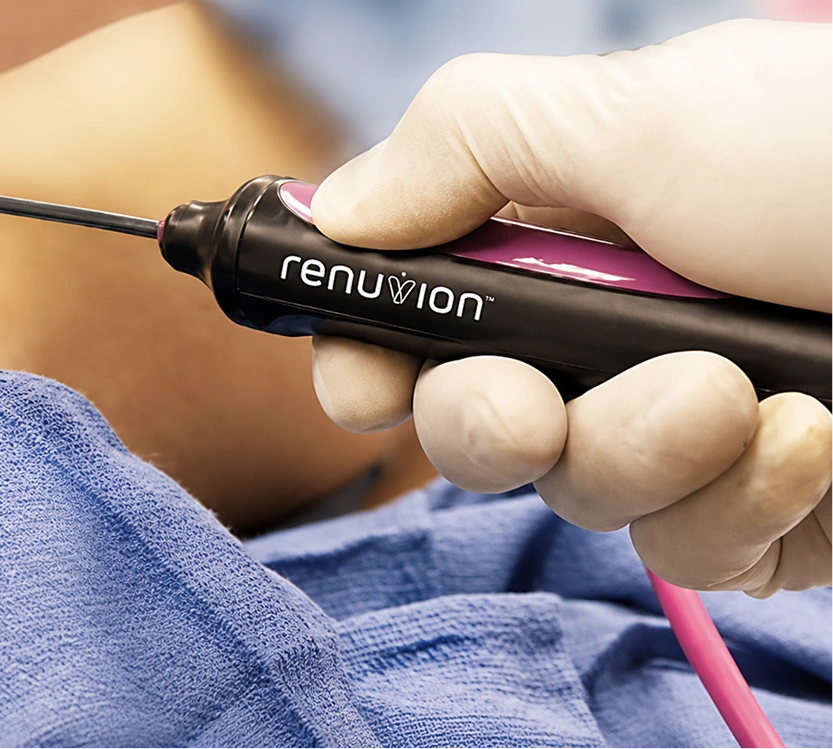 Practitioner holding Renuvion device with pink applicator tip during skin treatment procedure